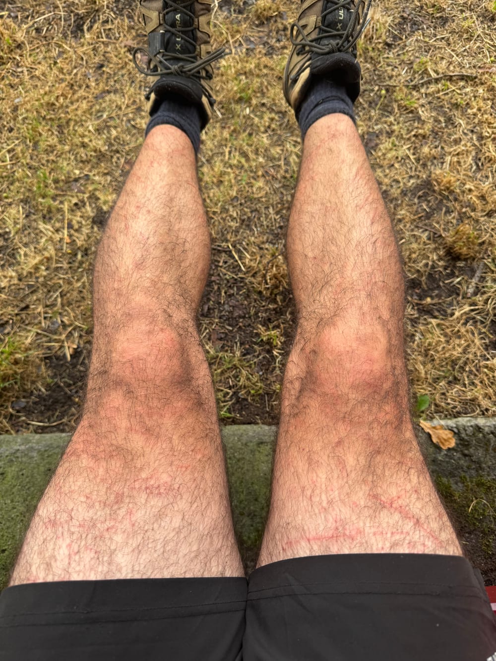 Jambes écorchées. Alternance de milieux sur la HRP.